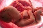 ۸۹ مجوز سقط‌ جنین در قم صادر شد/ تشریح شرایط صدور مجوز سقط جنین